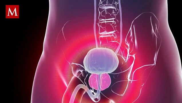 Cáncer de próstata: ¿Tienes estos síntomas? Señales CLAVE que debes saber