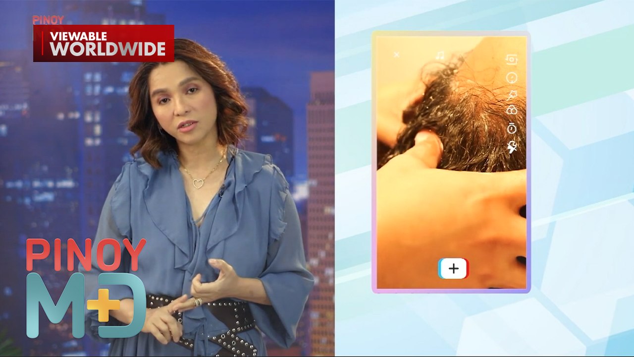 Ano ang lunas sa matinding balakubak at varicose veins? | Pinoy MD