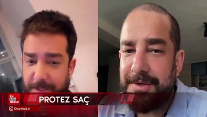 Oyuncu Enis Arıkan'ın saçsız hali