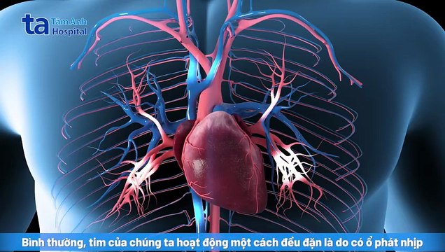 Nguyên nhân rối loạn nhịp tim: Triệu chứng, chẩn đoán và điều trị