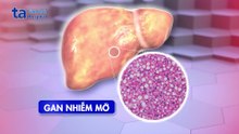 Chẩn đoán và điều trị gan nhiễm mỡ