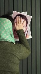 نتیجه فوق‌العاده کاشت مو با تراکم بالا | مقایسه عکس قبل و بعد