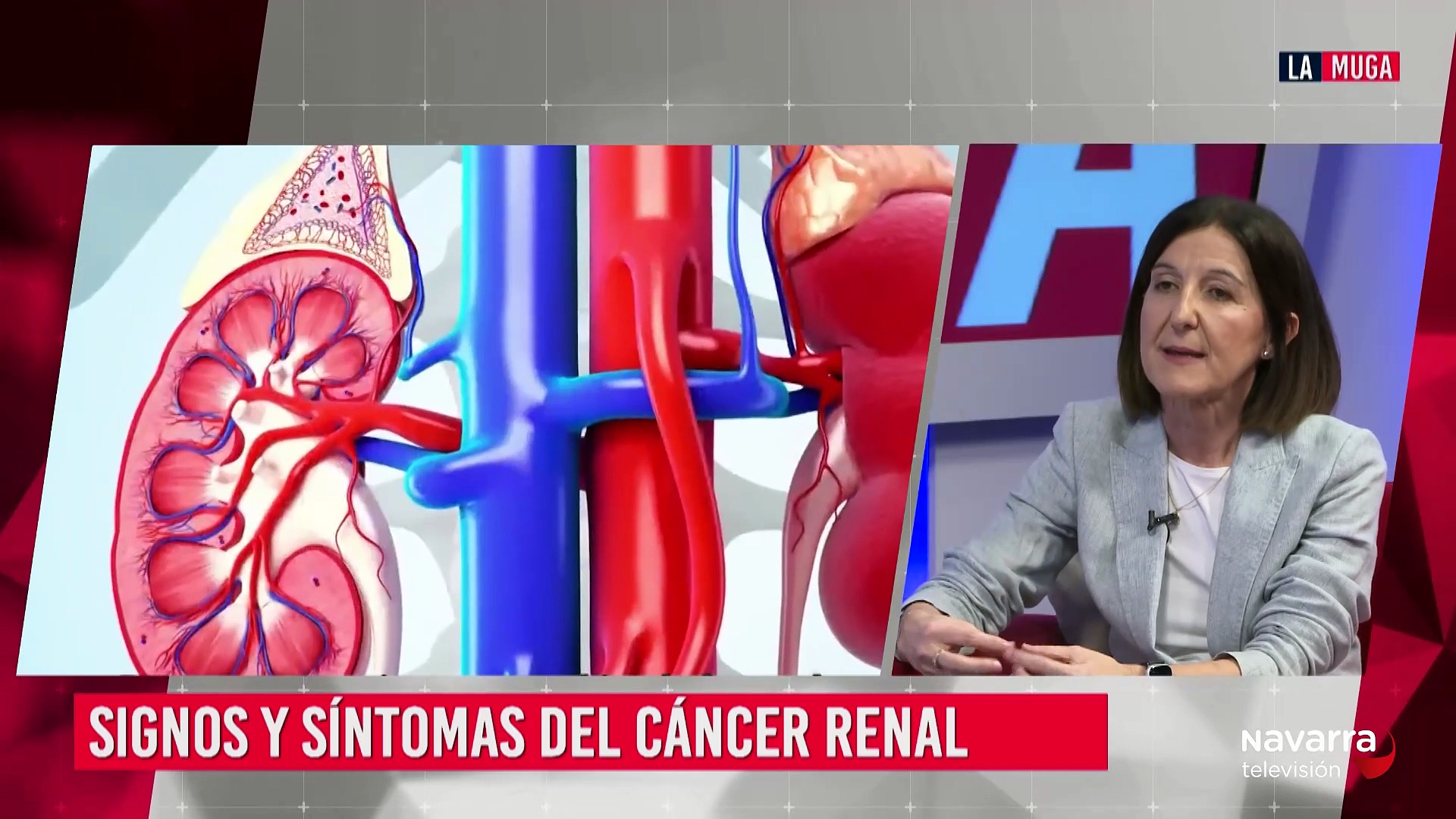 Vivir con cáncer de riñón: así avanzan los tratamientos en Navarra