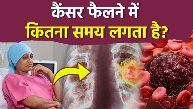 Does Spread Overnight: कैंसर को फैलने में कितना समय लगता है...|Boldsky