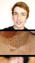 As-tu cette phobie ?