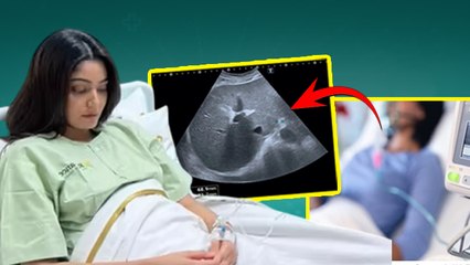 Sana Makbul Liver Transplant: Stage 4 Cirrhosis के बाद हुई अस्पताल में भर्ती, Treatment...