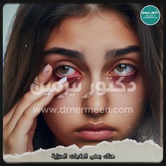 علاج تورم العين في المنزل viral #viralvide # #صحة #صحية #علاج #العين #تورم #عين #العيون