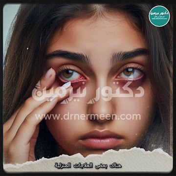 علاج تورم العين في المنزل viral #viralvide # #صحة #صحية #علاج #العين #تورم #عين #العيون