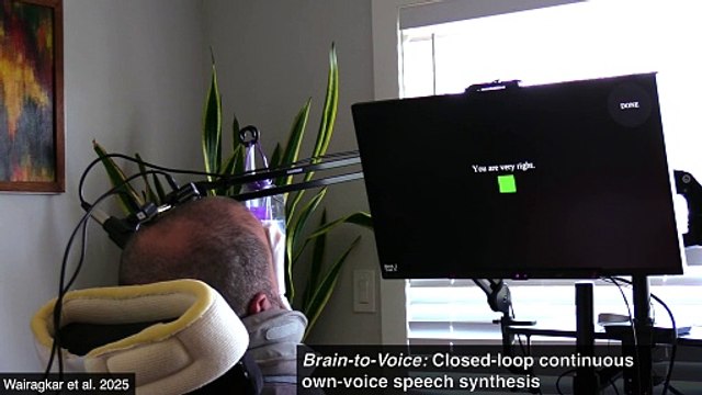 Un patient retrouve la voix grâce à un implant et à l'IA