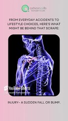 5 Surprising Causes of Skin Abrasions You Didn't Know About