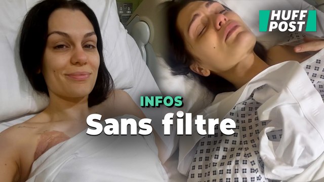 La chanteuse Jessie J montre la réalité de son cancer du sein sans filtre