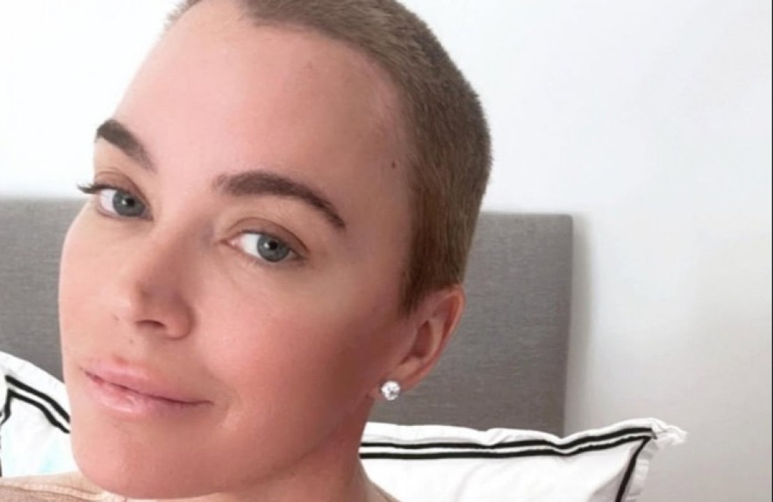 Teddi Mellencamp sieht 'deutliche Veränderung' ihres Haarwuchses nach Krebsbehandlung