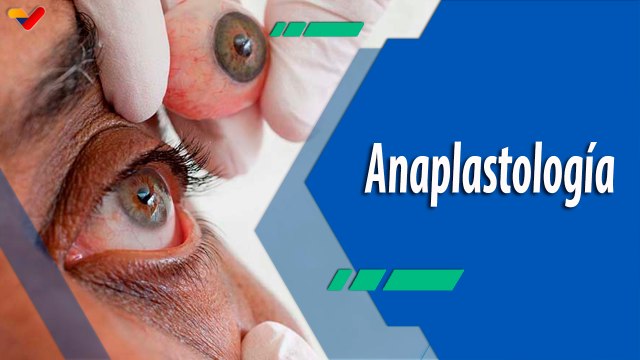 Actitud Saludable | Anaplastología: Rehabilitando cuerpos con arte y ciencia