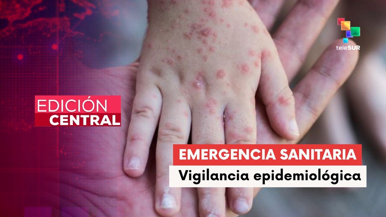 Gobierno de Bolivia activa medidas urgentes ante brote de sarampión