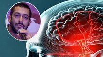 Salman को brain aneurysm, जानिए बीमारी क्या है और इलाज?