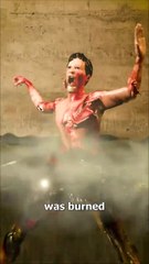 He Fell Into Boiling Water 😱