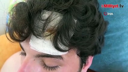 Oyuncu Mehmet Akif Akdeniz trafikteki dehşeti anlattı! 'Her yerim yara içindeydi'