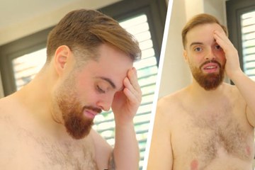 Ibai cumple un año de cambio físico