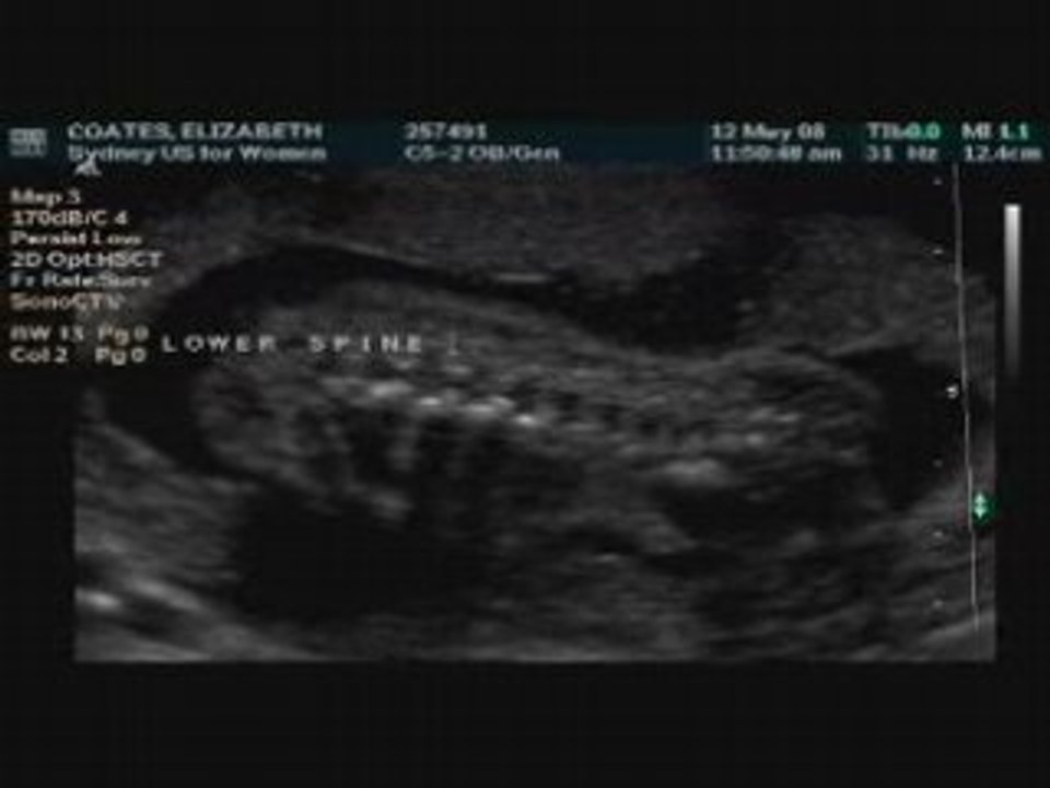 Ultrasound - Director's Cut