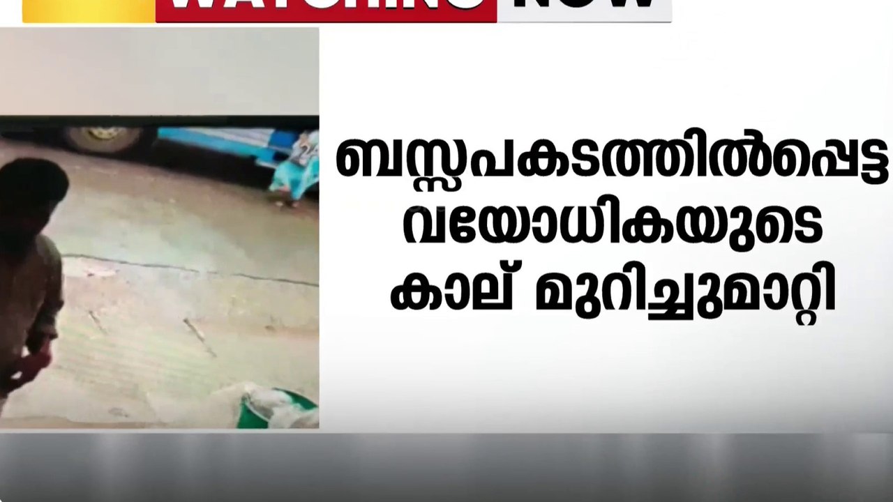 ഇടുക്കിയിൽ സ്വകാര്യ ബസ് കാലിലൂടെ കയറിയിറങ്ങി ചികിത്സയിൽ   കഴിയുന്ന വയോധികയുടെ കാൽ മുറിച്ചുമാറ്റി