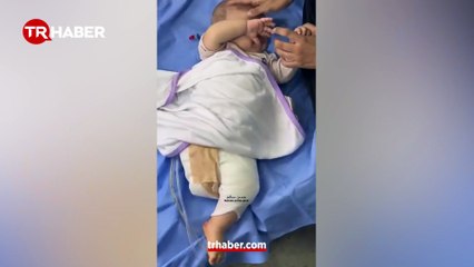 Çocuk olmanın yasak olduğu yer: Gazze! İsrail saldırısı sonrası 4 yaşındaki bebek bacağını kaybetti!