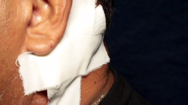 Funcionário Público esfaqueado em Assalto a BRT: Suspeito é Preso após Perseguição Policial em Recife