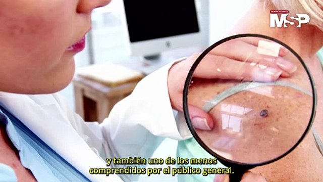 Melanoma El Cáncer de Piel Más Agresivo y de Rápida Expansión