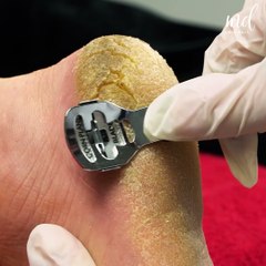 The summer pedicure transformation we need!
