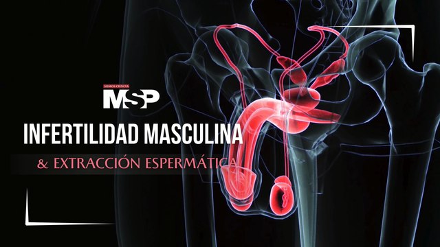 Infertilidad masculina y extracción espermáticaa