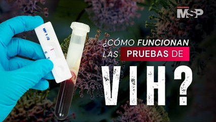 ¿Cómo funcionan las pruebas de VIH?