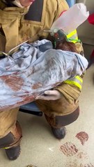 Cachorra prenha é salva após tutor colocar fogo acidentalmente em casa; vídeo