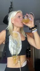 Hello world This is me I live with chronic cancer and on my last Operation I became with bags 🥺