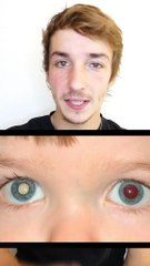 Si vous voyez ça sur votre enfant...