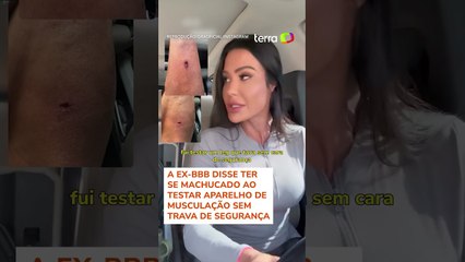 Gracyanne Barbosa relata acidente durante treino e desabafa: 'Tíbia bem sensível' #shorts