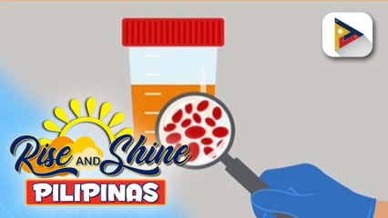 Say ni DOK | Hematuria o pagkakaroon ng dugo sa ihi, posibleng senyales ng chronic kidney disease