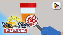 Say ni DOK | Hematuria o pagkakaroon ng dugo sa ihi, posibleng senyales ng chronic kidney disease