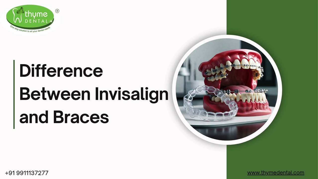 Difference Between Invisalign and Braces- Thyme Dental