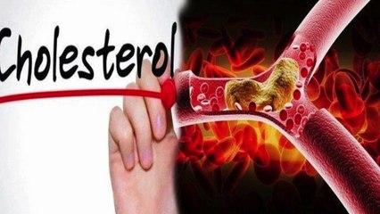 4 Tanda Kolesterol Tinggi di Wajah yang Tidak Boleh Diabaikan jangan sampai menyesal ya