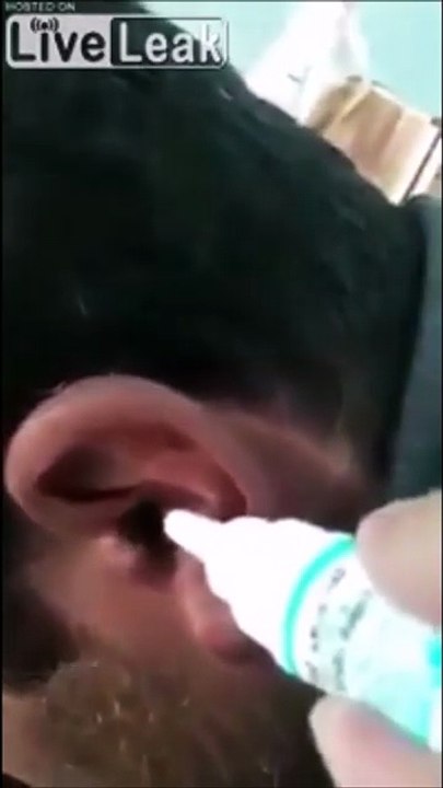 Ce qui sort de son oreille est un peu flippant