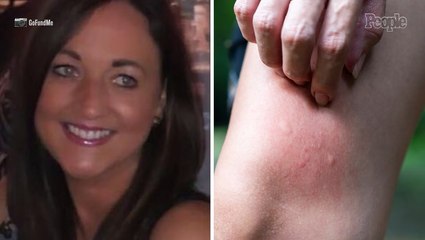 Vacationing Mom Collapses, Falls Down Stairs, Hits Head and Fractures Neck After 'Dozens and Dozens' of Mosquito Bites