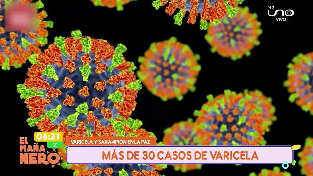 ALERTA POR SARAMPION Y VARICELA