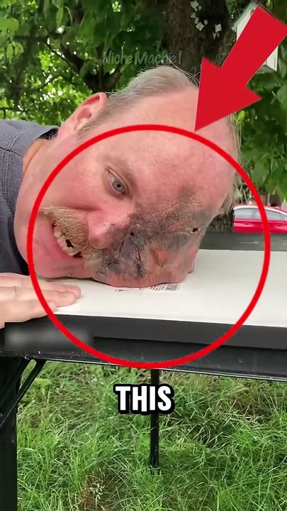 What’s Happening to His Face ! 😱