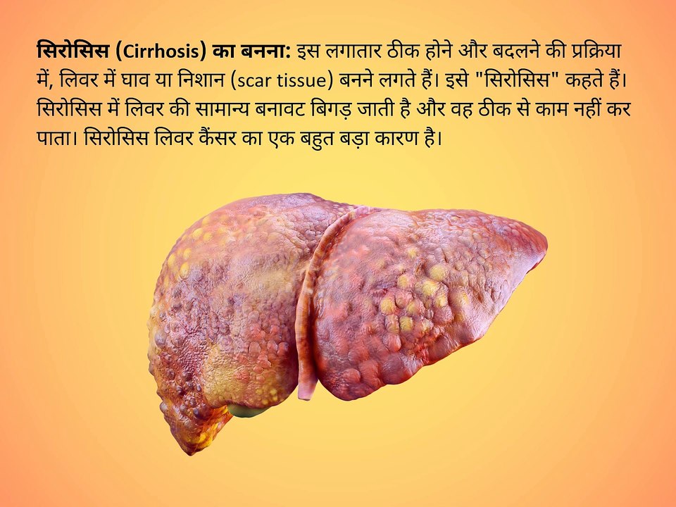 Chronic hepatitis B and C infections are major risk factors for liver cancer (hepatocellular carcinoma) as they cause persistent liver inflammation and damage, often leading to cirrhosis, which significantly increases cancer risk.