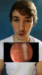 Tu peux attraper ce parasite