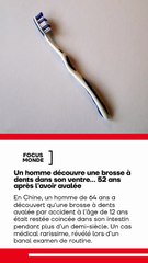 🚨🦷🇨🇳 insolite | Il consulte pour une gêne au ventre… et les médecins découvrent une brosse à dents avalée il y a 52 ANS 😱 À 64 ans, ce patient chinois n’avait aucun symptôme grave. L’histoire défie la logique médicale 🧠