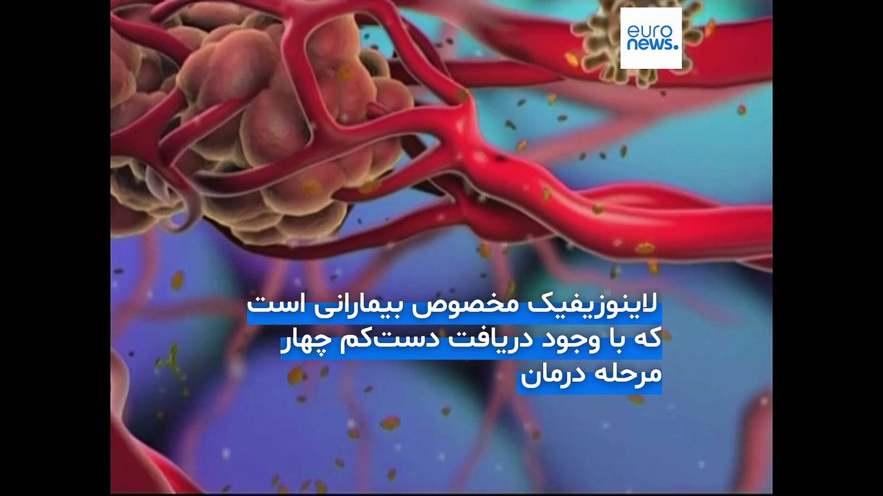 تأیید دارویی نوآورانه که به بیماران سرطان خون فرصت زندگی دوباره می‌دهد؛ لاینوزیفیک چیست؟