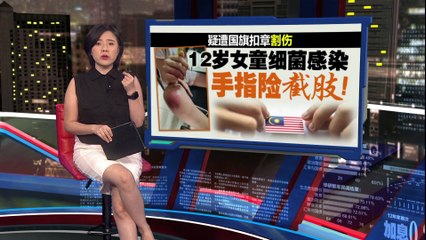 疑遭国旗扣章割伤   12岁女童感染细菌   手指险截肢