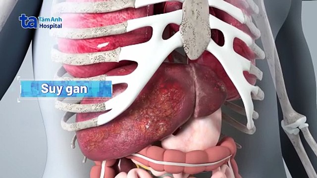 Xét nghiệm viêm gan virus là gì, cần nhịn ăn không?