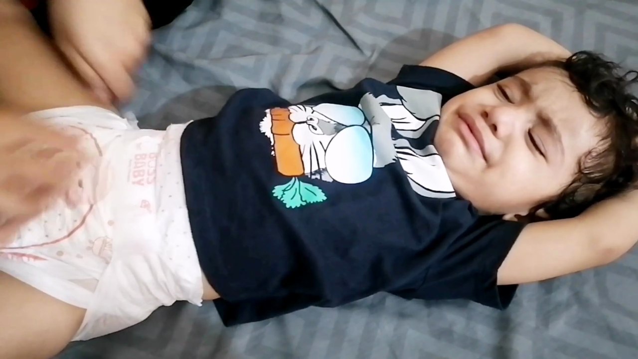 Rashes made baby out of control | Screaming Baby😱