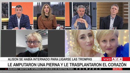 De una cirugía de rutina a un trasplante de corazón: el dramático caso de Alison Calfunao